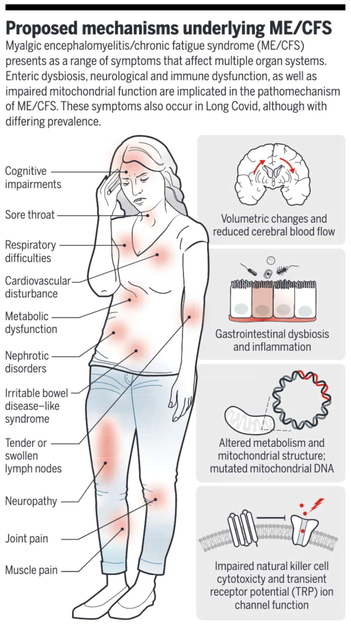 Understanding chronic fatigue syndrome/ myalgic encephalomyelitis